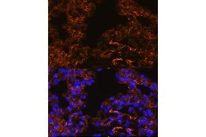 Immunofluorescence analysis of Rat lung cells using Caveolin-1 antibody (ABIN6131271, ABIN6137992, ABIN6137993 and ABIN6218615) at dilution of 1:100. (Caveolin-1 antibody  (AA 1-100))