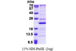 Ribosomal Protein L26 (RPL26) (AA 1-145) protein (His tag)