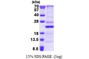 SDS-PAGE (SDS) image for Ribosomal Protein L26 (RPL26) (AA 1-145) protein (His tag) (ABIN5853064)