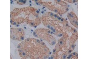Figure. (Kininogen (HMW) antibody  (AA 225-407))