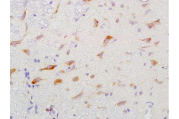 GGA2 antibody  (AA 161-260)