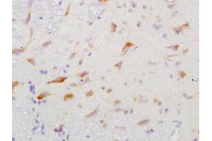 Formalin-fixed and paraffin embedded rat brain labeled with Anti-GGA2 Polyclonal Antibody, Unconjugated  at 1:200 followed by conjugation to the secondary antibody and DAB staining