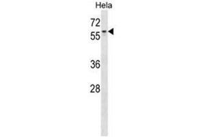 AGFG1 Antibody (N-term) western blot analysis in Hela cell line lysates (35 µg/lane).