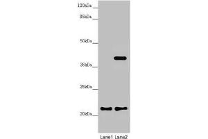 Western blot All lanes: DCTN6 antibody at 3. (DCTN6 antibody  (AA 1-190))