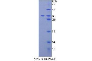 SDS-PAGE analysis of Mouse GLVR1 Protein. (SLC20A1 Protein)