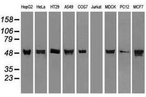 Image no. 3 for anti-Keratin 8 (KRT8) (AA 91-381) antibody (ABIN1491713) (KRT8 antibody  (AA 91-381))