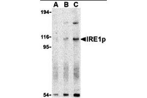 Western Blotting (WB) image for anti-Endoplasmic Reticulum To Nucleus Signaling 1 (ERN1) (N-Term) antibody (ABIN1031419) (ERN1 antibody  (N-Term))