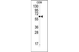 Western blot analysis of anti-CYP2J2 Antibody (Center) in CEM cell line lysates (35ug/lane). (CYP2J2 antibody  (Middle Region))