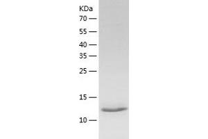 Western Blotting (WB) image for Tumor Necrosis Factor (Ligand) Superfamily, Member 13b (TNFSF13B) (AA 134-285) protein (His tag) (ABIN7125529) (BAFF Protein (AA 134-285) (His tag))