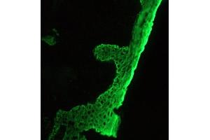 Immunohistochemistry on frozen sections of human skin (Basal Cell Cytokeratin antibody)