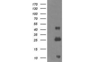 Western Blotting (WB) image for anti-Aldehyde Dehydrogenase 1 Family, Member A3 (ALDH1A3) (AA 1-100), (AA 413-512) antibody (ABIN1490536) (ALDH1A3 antibody  (AA 1-100, AA 413-512))