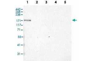 Western Blot analysis of recombinant protein Lane 1: Laminin-332, Lane 2: Laminin-421, Lane 3: Laminin-511, Lane 4: Laminin-121 and Lane 5: Laminin-221 with LAMA3 monoclonal antibody, clone CL3112 . (LAMA3 antibody)