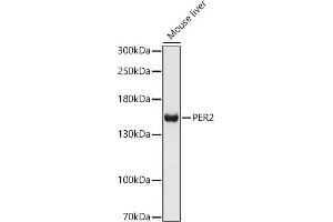 Western blot analysis of extracts of Mouse liver, using PER2 antibody (ABIN6131889, ABIN6145450, ABIN6145452 and ABIN6217063) at 1:1000 dilution. (PER2 antibody  (AA 1-150))