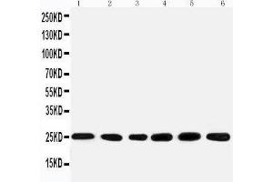 Anti-SNRPN antibody, Western blotting Lane 1: Rat kidney Tissue Lysate Lane 2: U87 Cell Lysate Lane 3: U87 Cell Lysate Lane 4: HELA Cell Lysate Lane 5: HMY Cell Lysate Lane 6: NEUR Cell Lysate (SNRPN antibody  (N-Term))