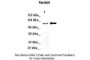 Lanes:   Lane 1: 50ug Mouse adipose lysate  Primary Antibody Dilution:   1:1000  Secondary Antibody:   Donkey anti-Rabbit-HRP  Secondary Antibody Dilution:   1:10000  Gene Name:   NEDD4  Submitted by:   Libin Liu, Boston University. (NEDD4 antibody  (Middle Region))