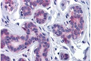 Human Breast: Formalin-Fixed, Paraffin-Embedded (FFPE) (AKT3 antibody  (AA 119-136))