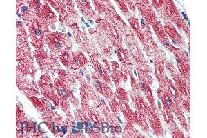 Immunohistochemistry (IHC) image for anti-Desmin (DES) (C-Term) antibody (ABIN334386)