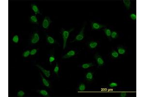 Immunofluorescence of monoclonal antibody to LEF1 on HeLa cell. (LEF1 antibody  (AA 14-123))
