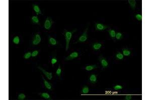 Immunofluorescence of monoclonal antibody to LEF1 on HeLa cell.