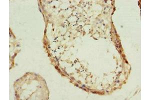 Immunohistochemistry of paraffin-embedded human testis tissue using ABIN7163042 at dilution of 1:100 (PHF1 antibody  (AA 151-360))