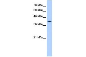 WB Suggested Anti-M6PR Antibody Titration:  5. (M6PR antibody  (N-Term))