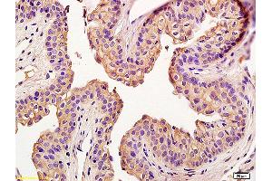 Formalin-fixed and paraffin embedded rat penile labeled with Anti-Claudin 5 Polyclonal Antibody, Unconjugated (ABIN673869) at 1:200 followed by conjugation to the secondary antibody and DAB staining (Claudin 5 antibody)