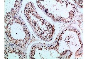 Immunohistochemical analysis of paraffin-embedded Human-testis, antibody was diluted at 1:100 (PIK3R2 antibody  (AA 1-60))