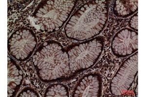 Immunohistochemistry (IHC) image for anti-Protein Disulfide Isomerase Family A, Member 3 (PDIA3) (Internal Region) antibody (ABIN6280937)