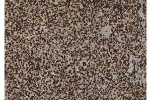 ABIN6267200 at 1/100 staining Mouse spleen tissue by IHC-P. (Topoisomerase II alpha antibody  (pSer1469))