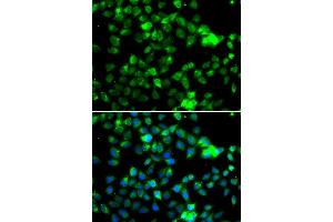 Immunofluorescence analysis of A549 cell using NAA20 antibody. (NAT5 antibody)
