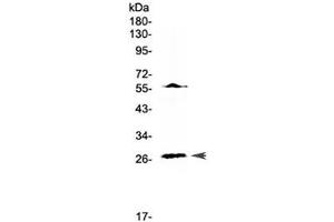 Western blot testing of human Jurkat cell lysate with IL17A antibody at 0. (Interleukin 17a antibody)