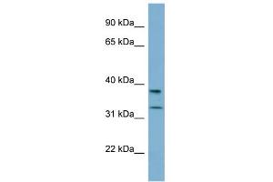 WB Suggested Anti-RALGPS2 Antibody Titration: 0. (RALGPS2 antibody  (N-Term))