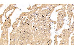 Detection of IL6 in Rat Cardiac Muscle Tissue using Polyclonal Antibody to Interleukin 6 (IL6) (IL-6 antibody  (AA 21-211))