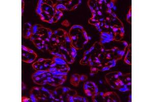 Immunofluorescence of paraffin embedded human placenta using Neil1 (ABIN7073820) at dilution of 1: 300 (400x lens) (NEIL1 antibody)