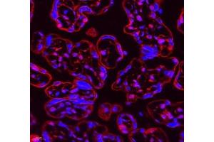 Immunofluorescence of paraffin embedded human placenta using Neil1 (ABIN7073820) at dilution of 1: 300 (400x lens)
