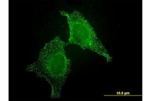 Immunofluorescence of monoclonal antibody to CIB1 on HeLa cell. (CIB1 antibody  (AA 1-191))