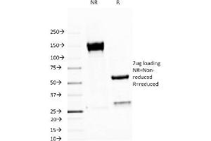 SDS-PAGE (SDS) image for anti-Mucin 1 (MUC1) antibody (ABIN6940099)