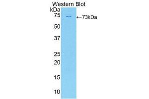 Western Blotting (WB) image for anti-Deiodinase, Iodothyronine, Type II (DIO2) (AA 30-259) antibody (ABIN1858637) (DIO2 antibody  (AA 30-259))