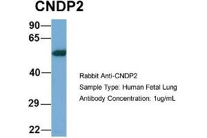 Host: Rabbit  Target Name: CNDP2  Sample Tissue: Human Fetal Lung  Antibody Dilution: 1. (CNDP2 antibody  (Middle Region))