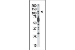Image no. 1 for anti-Phosphoinositide-3-Kinase, Catalytic, delta Polypeptide (PIK3CD) (C-Term) antibody (ABIN360448) (PIK3CD antibody  (C-Term))