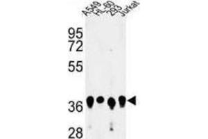 Western Blotting (WB) image for anti-Arginine and Glutamate Rich 1 (ARGLU1) antibody (ABIN3004117)