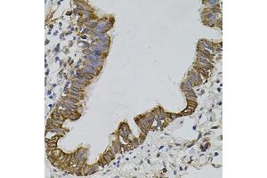 Immunohistochemistry of paraffin-embedded human lung using ARHGEF11 antibody (ABIN5995407) (40x lens).