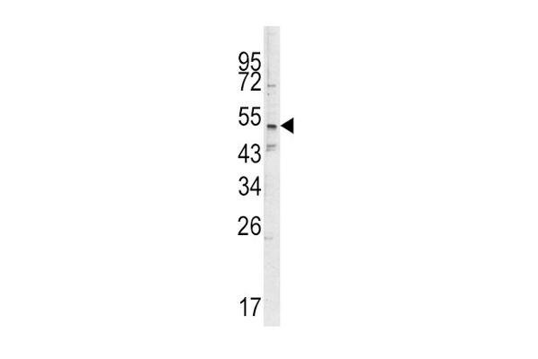 SMYD3 antibody  (N-Term)