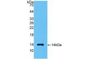 Detection of Recombinant MSTN, Human using Polyclonal Antibody to Myostatin (MSTN) (MSTN antibody  (AA 267-375))