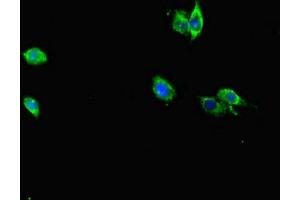 Immunofluorescent analysis of Hela cells using ABIN7167229 at dilution of 1:100 and Alexa Fluor 488-congugated AffiniPure Goat Anti-Rabbit IgG(H+L) (RAB12 antibody  (AA 98-241))