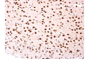 IHC-P Image beta-TrCP antibody [N1C1] detects beta-TrCP protein at nucleus on rat fore brain by immunohistochemical analysis. (BTRC antibody)