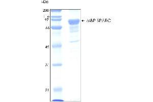 10% SDS-PAGE stained with Coomassie Blue (CB) and peptide fingerprinting by MALDI-TOF mass spectrometry