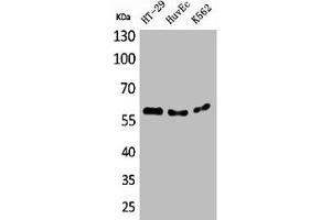 Western Blot analysis of HT29 HuvEc K562 cells using CYP11B1/2 Polyclonal Antibody (CYP11B1 antibody  (N-Term))