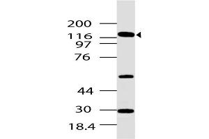 Image no. 1 for anti-Zinc Finger Protein GLI1 (GLI1) (AA 881-1000) antibody (ABIN5027219) (GLI1 antibody  (AA 881-1000))