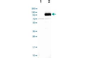Western blot analysis of Lane 1: Negative control (vector only transfected HEK293T lysate), Lane 2: Over-expression Lysate (Co-expressed with a C-terminal myc-DDK tag (~3. (DLG3 antibody)